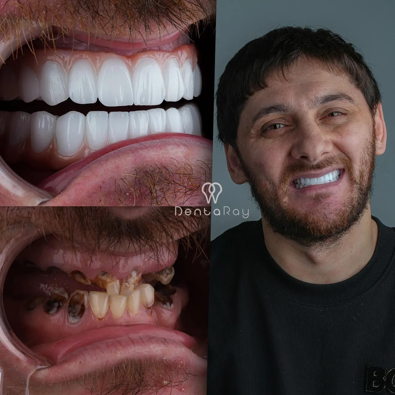 Advanced 3D Technology used at Dentaray Clinics