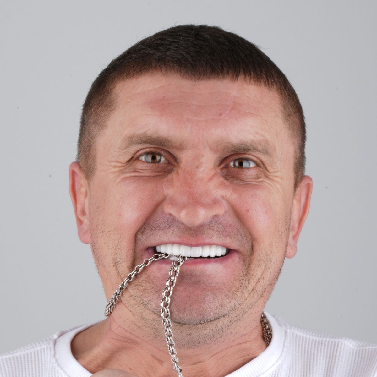 Before Treatment