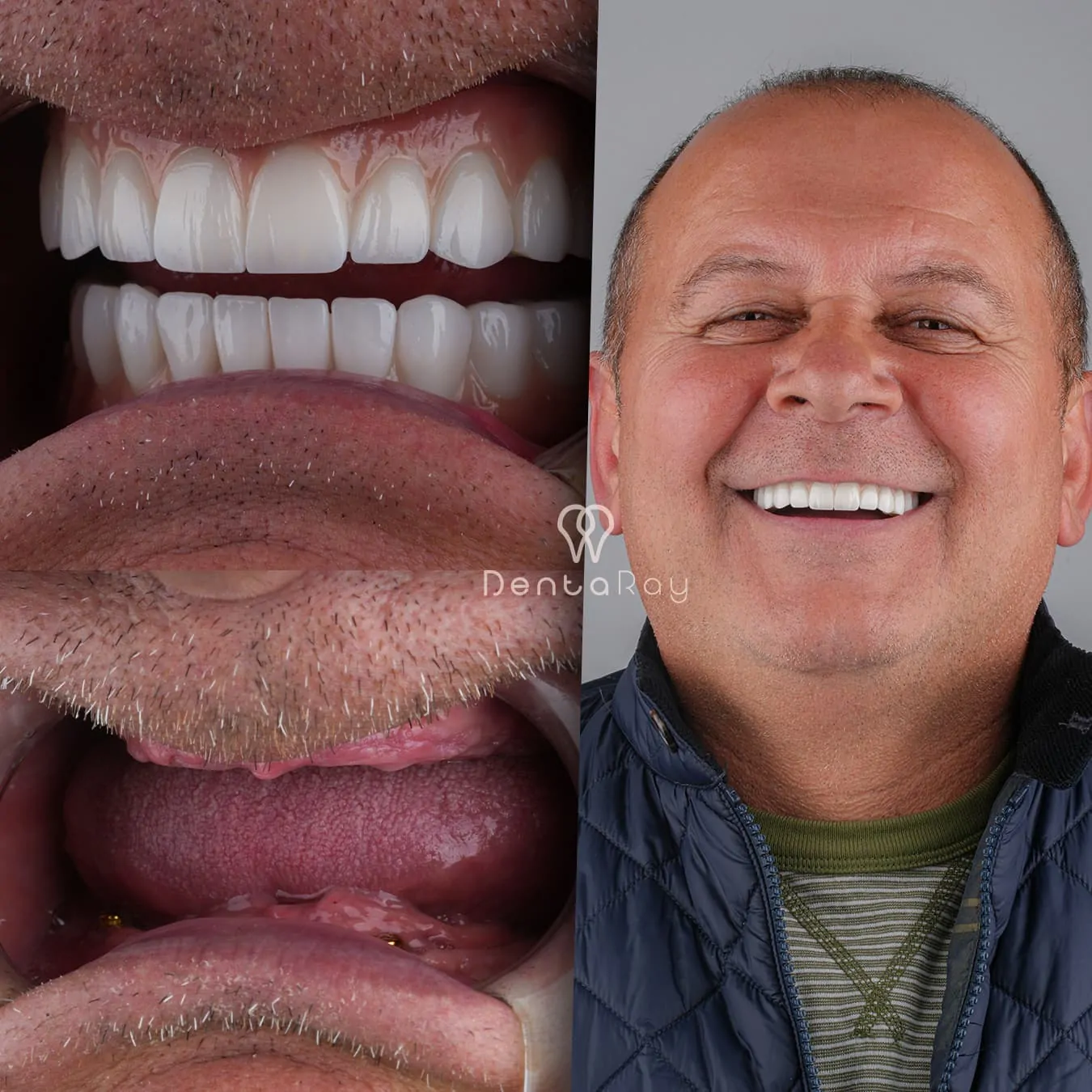 Dentaray Clinical Excellence