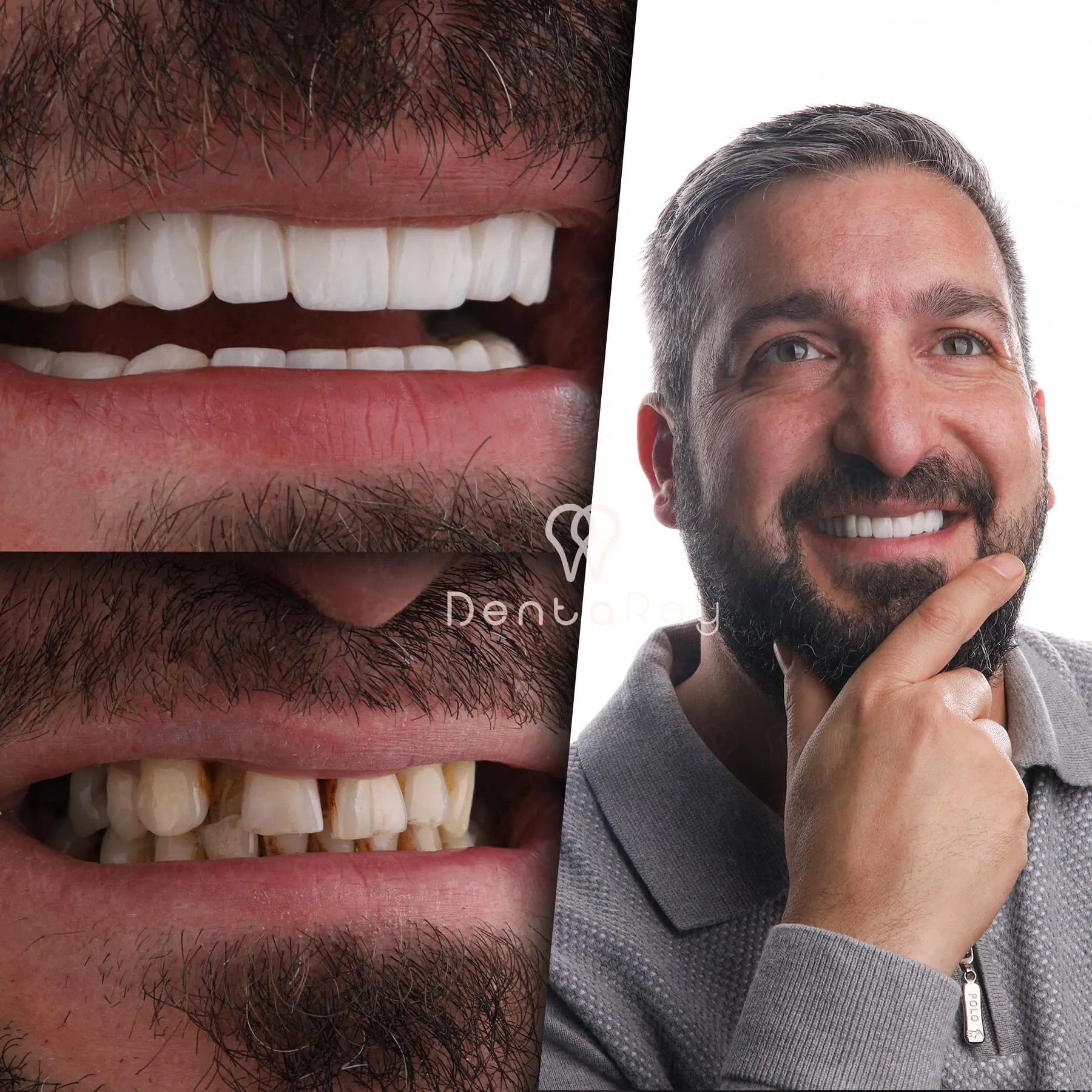 Dentaray Clinical Excellence