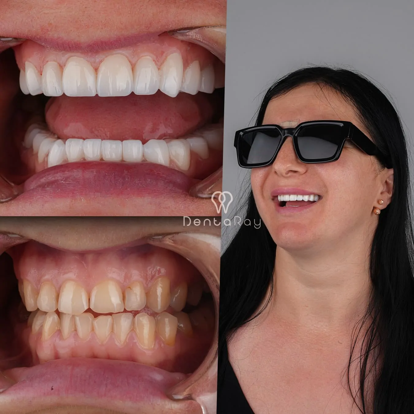 Dentaray Advanced Technology