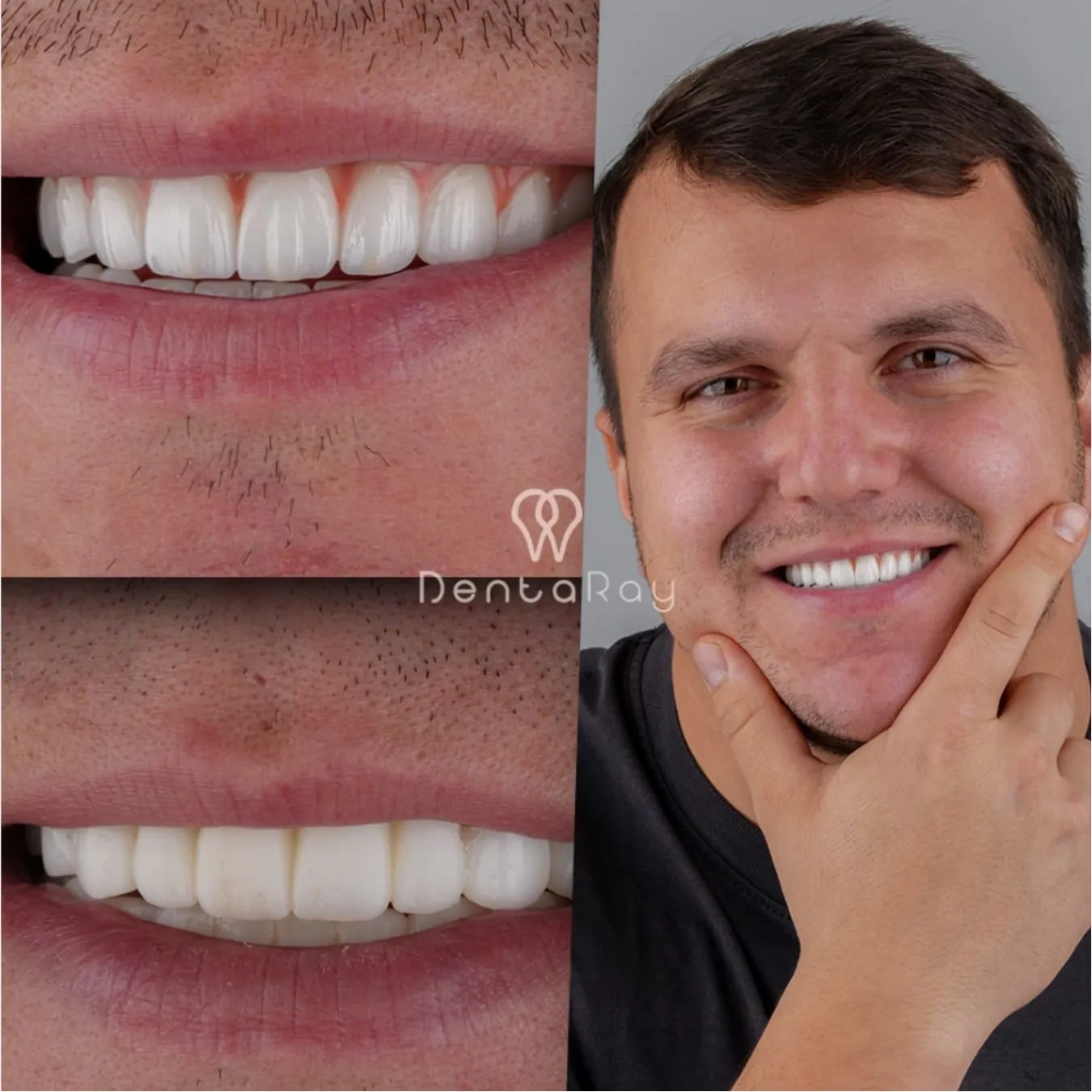 Happy Patient Smile