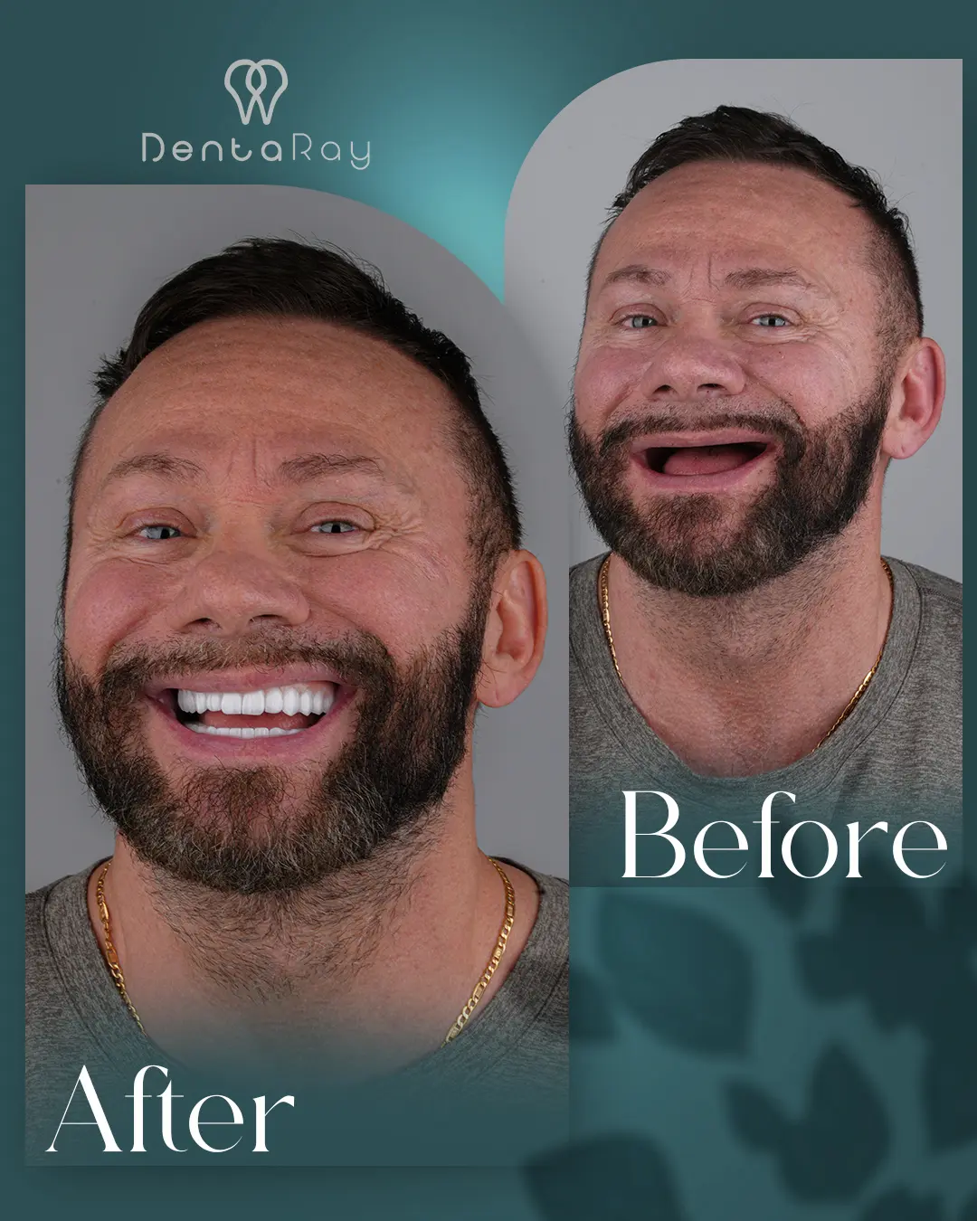 Клинические детали