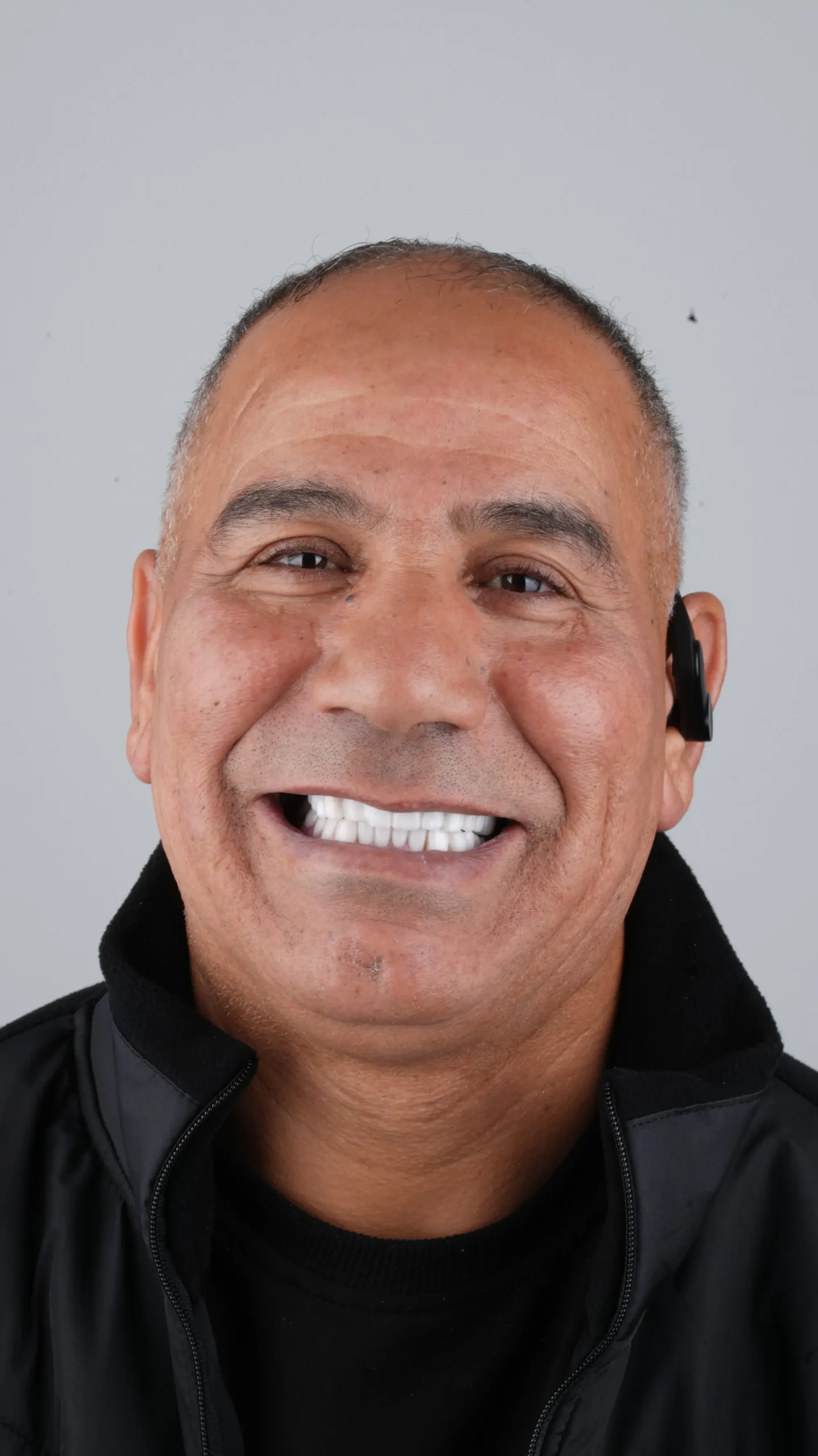 Dentaray Patient Highlight 4
