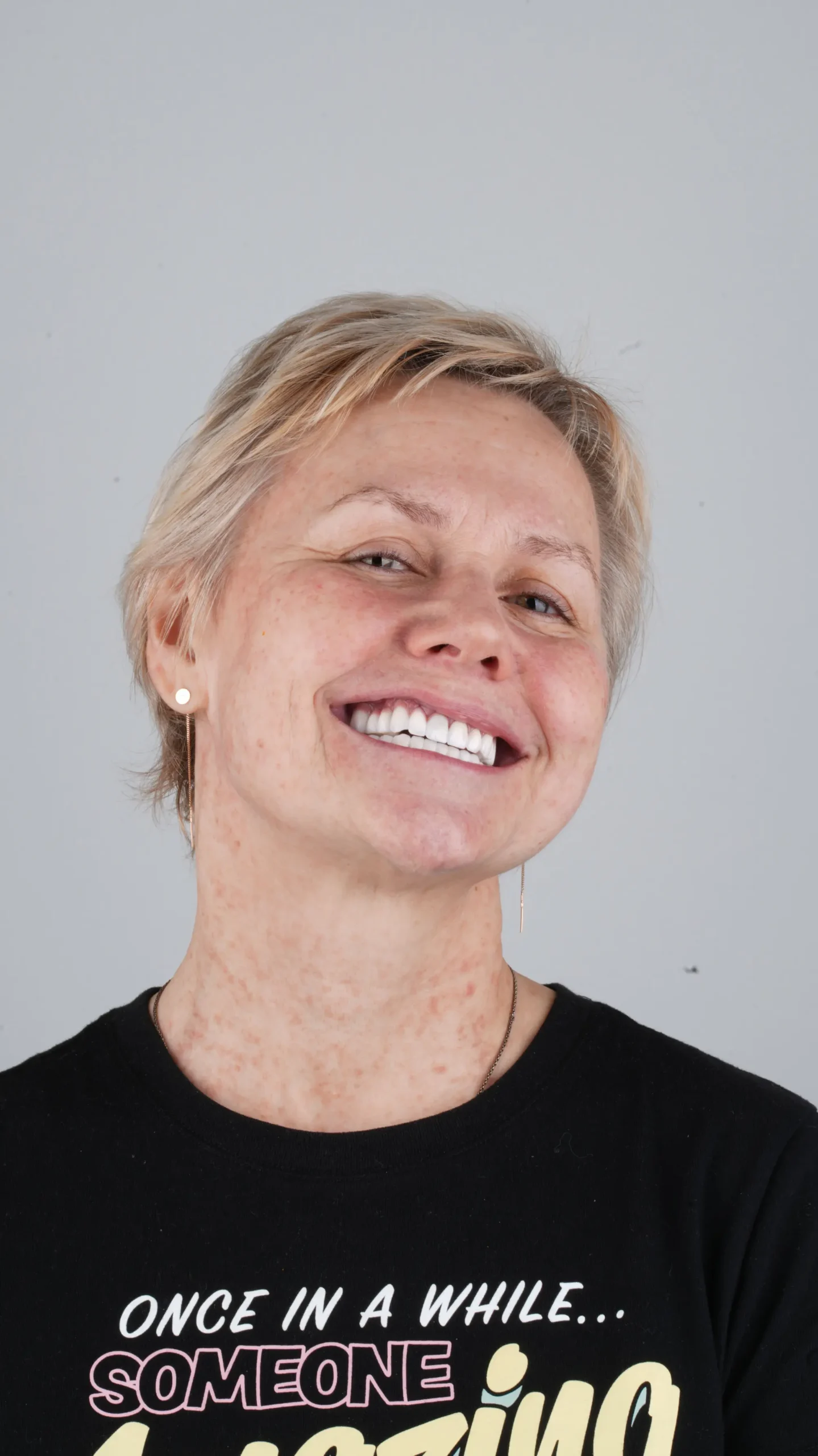 Dentaray Patient Highlight 6