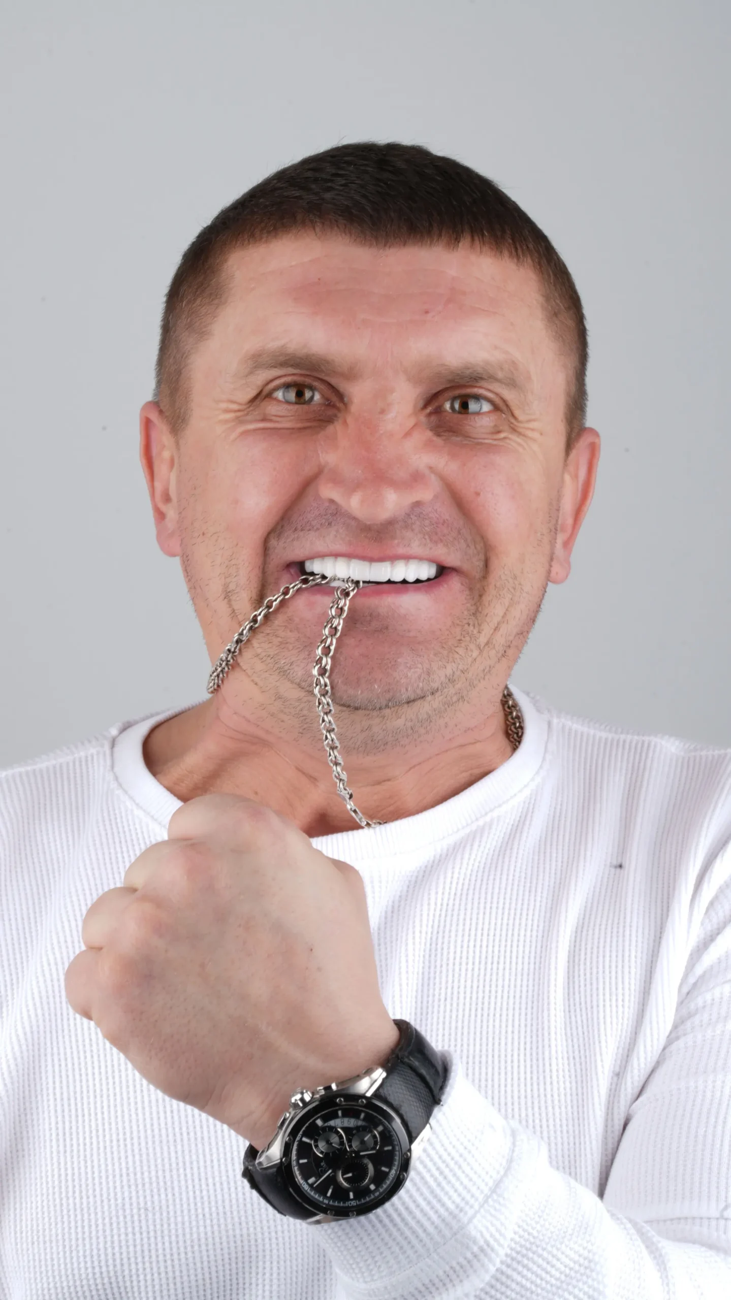 Dentaray Patient Highlight 3