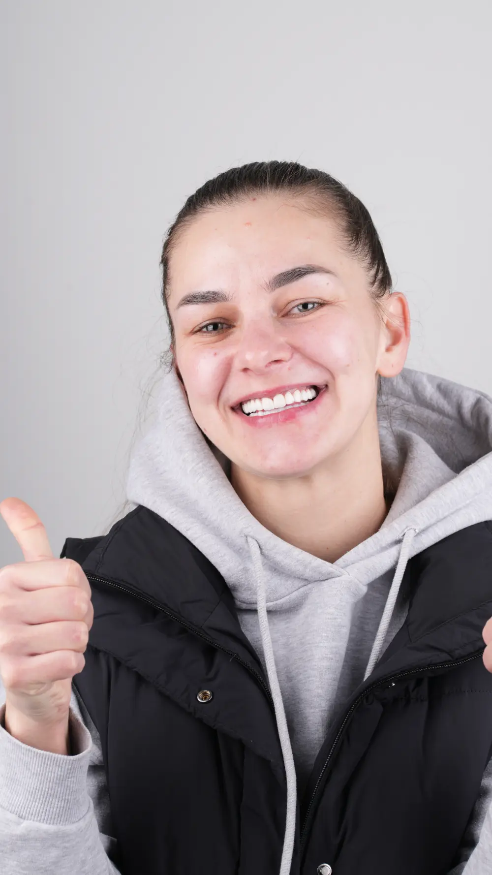 Dentaray Patient Highlight 10