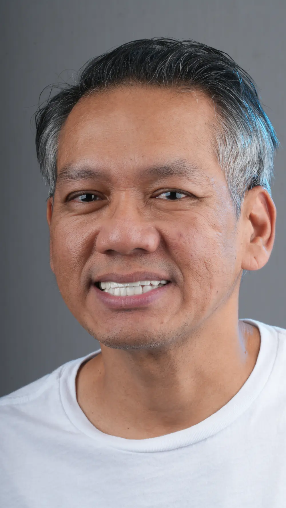 Dentaray Patient Highlight 13